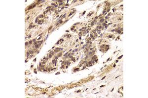 Immunohistochemistry of paraffin-embedded Human mammary gland using TDO2 antibody at dilution of 1:100 (x400 lens). (TDO2 Antikörper)