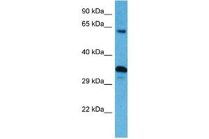 Host:  Mouse  Target Name:  SRC  Sample Tissue:  Mouse Spleen  Antibody Dilution:  1ug/ml (Src Antikörper  (N-Term))