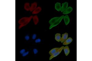 ABIN6265335 and ABIN6266873 staining Hela cells(30 min of UV treatment) by IF/ICC.