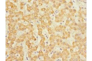 Immunohistochemistry of paraffin-embedded human liver tissue using ABIN7146045 at dilution of 1:100 (C-Type Lectin Domain Family 1, Member B (CLEC1B) (AA 55-229) Antikörper)