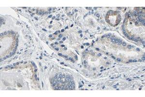 ABIN6274781 at 1/100 staining Human prostate tissue by IHC-P.
