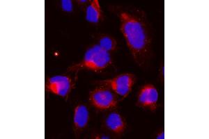 IF analysis of CCNB1 using anti-CCNB1 antibody (ABIN7599335). (Cyclin B1 Antikörper  (AA 1-383))