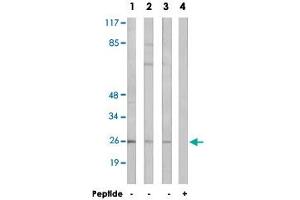 Western blot analysis of extracts from LoVo cells (Lane 1), K-562 cells (Lane 2 and lane 4) and HT-29 cells (Lane 3), using ARF4 polyclonal antibody . (ARF4 Antikörper  (AA 71-120))