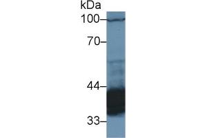 Detection of PDHb in Rat Cerebrum lysate using Polyclonal Antibody to Pyruvate Dehydrogenase Beta (PDHb) (PDHB Antikörper  (AA 31-341))
