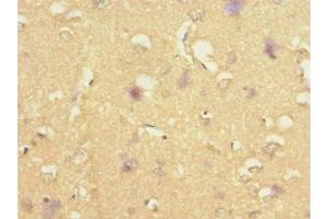 Immunohistochemistry of paraffin-embedded human brain tissue using ABIN7170732 at dilution of 1:100 (STRADA Antikörper  (AA 25-210))