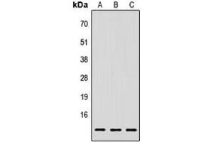 Western blot analysis of LY6E expression in HEK293T (A), Raw264. (LY6E Antikörper  (Center))