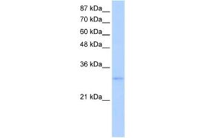 WB Suggested Anti-EXOSC6 Antibody Titration:  5. (EXOSC6 Antikörper  (N-Term))