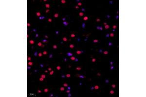 Immunofluorescence (Paraffin-embedded Sections) (IF (p)) image for anti-RNA Binding Motif Protein 45 (RBM45) antibody (ABIN7075477)