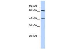 Image no. 1 for anti-Retinoblastoma Binding Protein 5 (RBBP5) (AA 431-480) antibody (ABIN6740370)