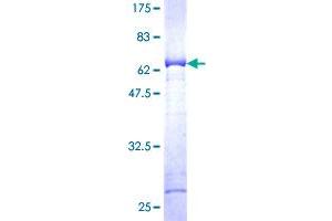 AKR1C3 Protein (AA 1-323) (GST tag)