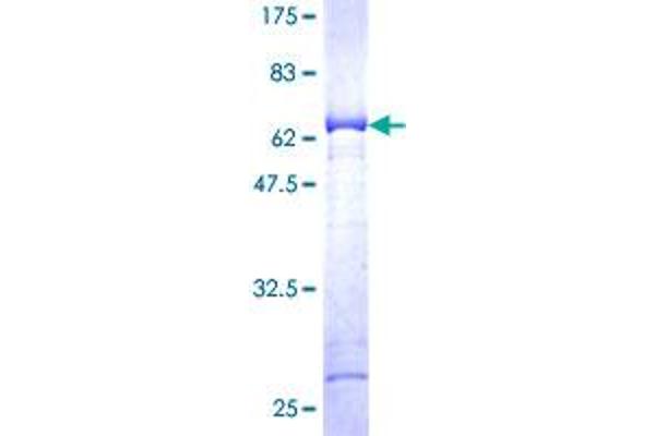 AKR1C3 Protein (AA 1-323) (GST tag)