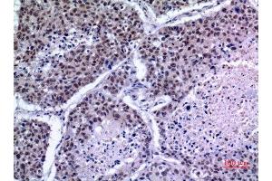 Immunohistochemistry (IHC) analysis of paraffin-embedded Human Lung, antibody was diluted at 1:100. (KLF13 Antikörper)
