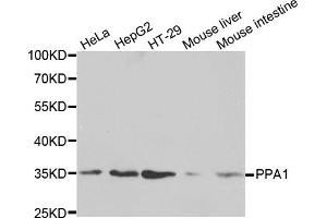 Western blot analysis of extracts of various cell lines, using PPA1 antibody. (Pyrophosphatase (Inorganic) 1 (PPA1) Antikörper)
