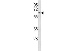 Western Blotting (WB) image for anti-Eukaryotic Translation Initiation Factor 2A, 65kDa (EIF2A) (AA 437-465) antibody (ABIN3030889)