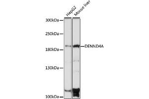 Western blot analysis of extracts of various cell lines, using DENND4A antibody (ABIN7266729) at 1:1000 dilution. (DENND4A Antikörper  (AA 1500-1650))