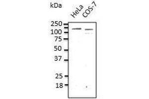 Endogenous CDHI detected with anti-CDH1at 1/500 dilution, lysate at 100 µg per Iane and rabbit polyclonal to goat lgG (HRP) at 1/10,00 dilution. (E-cadherin Antikörper)