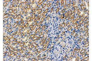 ABIN6262851 and ABIN6277626 at 1/100 staining Rat kidney tissue by IHC-P. (Kallikrein 7 Antikörper  (Internal Region))