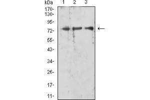 Western blot analysis using RIPK1 mouse mAb against HL-60 (1), K562 (2), and Jurkat (3) cell lysate. (RIPK1 Antikörper  (AA 131-277))