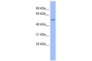 WB Suggested Anti-PTK6 Antibody Titration: 0. (PTK6 Antikörper  (Middle Region))