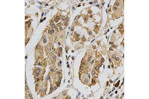 Immunohistochemistry of paraffin-embedded human stomach using MAPK10 antibody at dilution of 1:200 (x400 lens) (MAPK10 Antikörper  (AA 175-464))