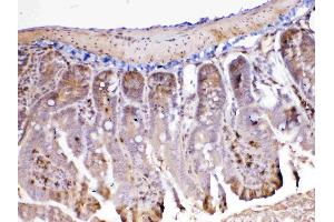 IHC analysis of ADA using anti-ADA antibody . (ADA Antikörper  (AA 2-241))