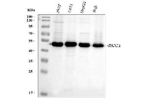 Western blot analysis of RCC1 using anti-RCC1 antibody (ABIN7600023).
