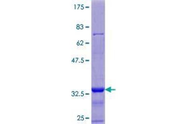 ARSJ Protein (AA 1-85) (GST tag)