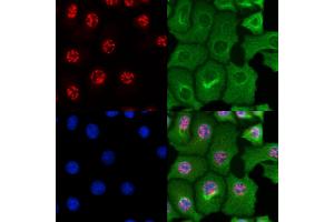 ABIN6264437 and ABIN6269102 staining HepG2 cells by IF/ICC. (Progesterone Receptor Antikörper  (Internal Region))