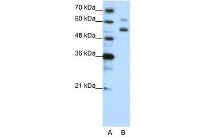 WDR4 antibody used at 1.