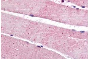 Immunohistochemistry (Formalin/PFA-fixed paraffin-embedded sections) of human skeletal muscle tissue with BEST3 polyclonal antibody . (Bestrophin 3 Antikörper  (C-Term))
