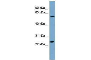 WB Suggested Anti-LRRC6 Antibody Titration: 0. (LRRC6 Antikörper  (N-Term))