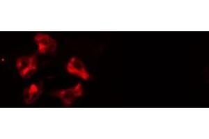ABIN6277118 staining  HeLa cells by IF/ICC. (Cullin 1 Antikörper)