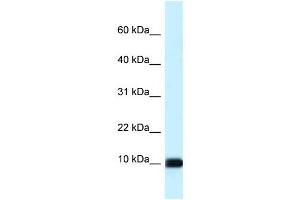 Western Blot showing CALML3 antibody used at a concentration of 1 ug/ml against Hela Cell Lysate