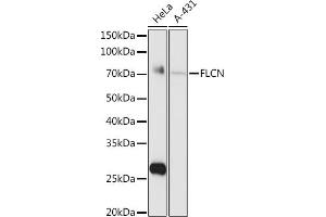 Western blot analysis of extracts of various cell lines, using FLCN antibody (ABIN6133517, ABIN6140670, ABIN6140672 and ABIN6222156) at 1:1000 dilution. (FLCN Antikörper  (AA 1-342))