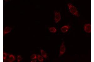 ABIN6275987 staining HuvEc by IF/ICC.