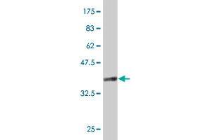 Western Blot detection against Immunogen (37 KDa) . (CD68 Antikörper  (AA 164-262))