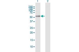 Western Blot analysis of ALDH7A1 expression in transfected 293T cell line by ALDH7A1 MaxPab polyclonal antibody. (ALDH7A1 Antikörper  (AA 1-511))
