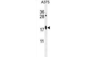 Western Blotting (WB) image for anti-ADP-Ribosylation Factor-Like 8A (ARL8A) antibody (ABIN2995545) (ARL8A Antikörper)