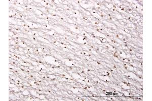 Immunostaining (ISt) image for anti-Sirtuin 1 (SIRT1) (AA 456-555) antibody (ABIN565071)