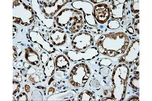 Immunohistochemical staining of paraffin-embedded Kidney tissue using anti-KIAA1609 mouse monoclonal antibody. (KIAA1609 Antikörper)