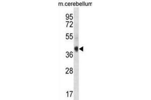 Western Blotting (WB) image for anti-AKT Interacting Protein (AKTIP) antibody (ABIN3000901) (AKTIP Antikörper)