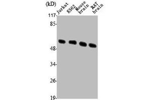 Western Blot analysis of Jurkat K562 MOUSE-BRAIN RAT-BRAIN cells using Tubulin β Polyclonal Antibody (TUBB3 Antikörper  (C-Term))