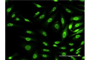 Immunofluorescence of monoclonal antibody to OXSR1 on HeLa cell. (OXSR1 Antikörper  (AA 351-450))