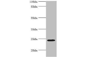 MIS12 Antikörper  (AA 1-305)