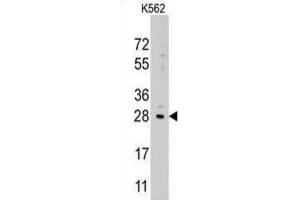 Western Blotting (WB) image for anti-Lin-28 Homolog B (LIN28B) antibody (ABIN2937586) (LIN28B Antikörper)