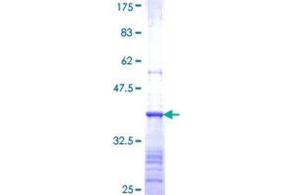 BAAT Protein (AA 258-355) (GST tag)