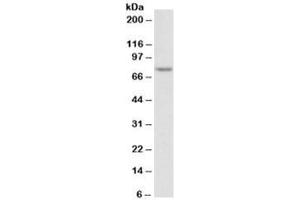 Western blot testing of Jurkat nuclear lysate with TDP1 antibody at 2ug/ml. (TDP1 Antikörper)