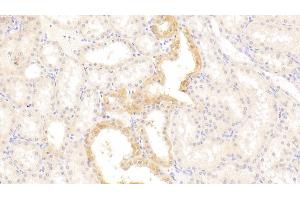 Immunohistochemistry (IHC) image for anti-Adiponectin Receptor 2 (ADIPOR2) (AA 2-155) antibody (ABIN7431155)