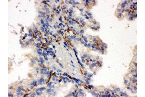 Immunohistochemistry (IHC) image for anti-Cytochrome P450, Family 27, Subfamily B, Polypeptide 1 (CYP27B1) (AA 475-508), (C-Term) antibody (ABIN3042787)