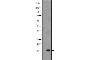 Western blot analysis of IL1F8 expression in A549 cell lysate with blocking peptide,The lane on the left is treated with the antigen-specific peptide.